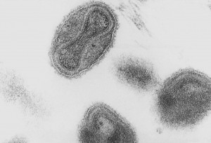 Smallpox_virus_virions_TEM_PHIL_1849